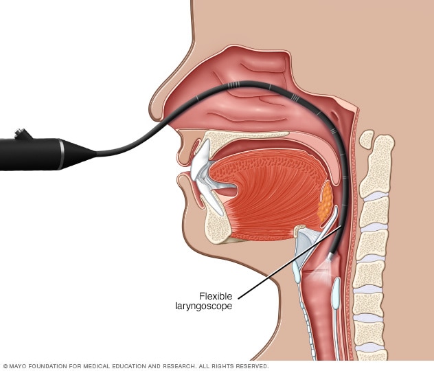 Laryngoscopy