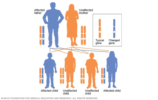 Illustration showing autosomal dominant inheritance pattern