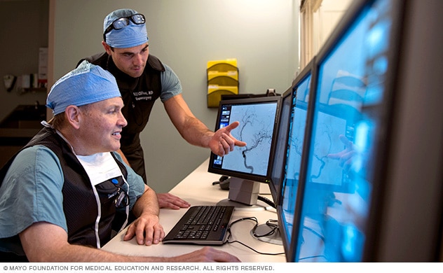 Mayo Clinic neurosurgeons review dAVF surgical options.