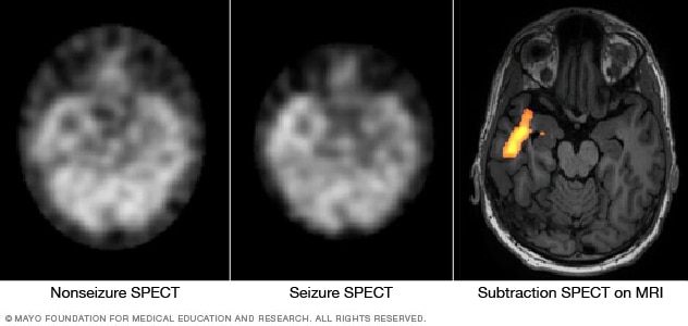 CT Scanner