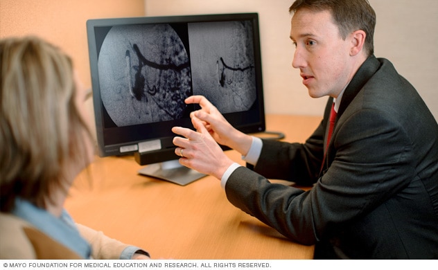 Spinal AVM consultation at Mayo Clinic