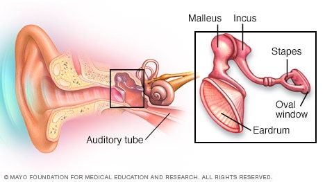 Ventricular tachycardia treatment at Mayo Clinic
