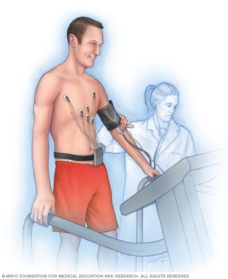 Man performing an exercise stress test