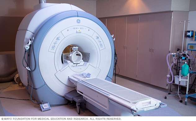 脑部 MRI 扫描