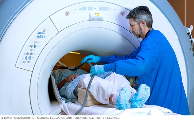 Brain MRI scan