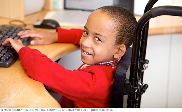 A child in a wheelchair typing at a computer