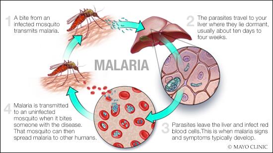 La Malaria - Mudo Social - Noticias del Perú